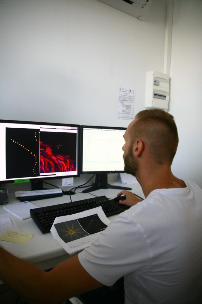 Super resolution microscopy